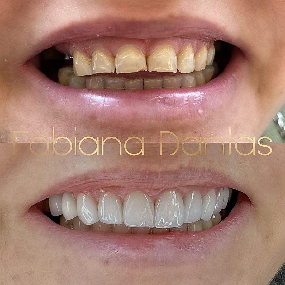 Boca2
