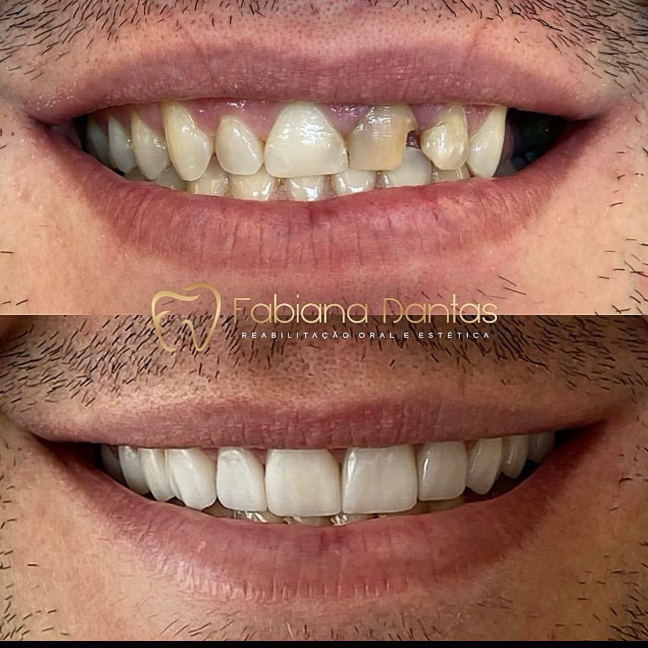 Boca6